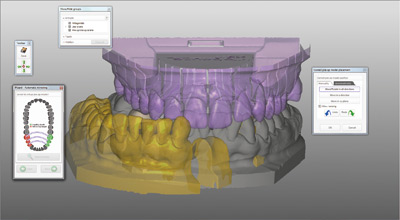 DentalCAD