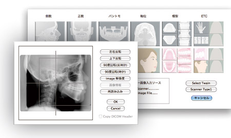 レントゲン画像取り込み