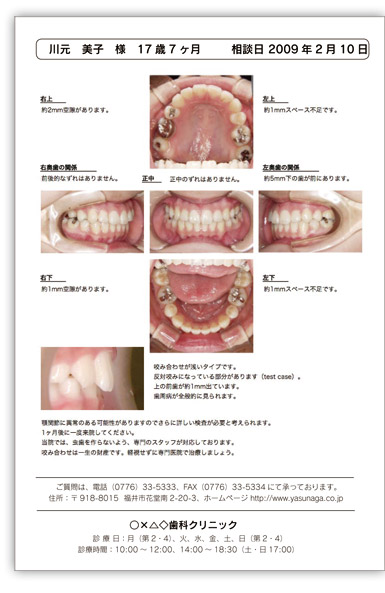 インフォームドコンセント