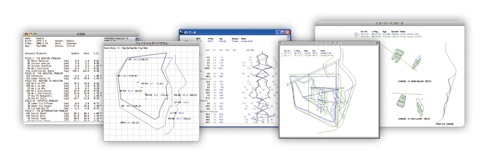 計測値・フェイシャルダイヤグラム・ポリゴン・重ね合わせ