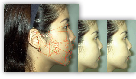 Orthodontic and Oral Surgery Simulation