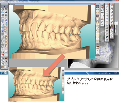 画面