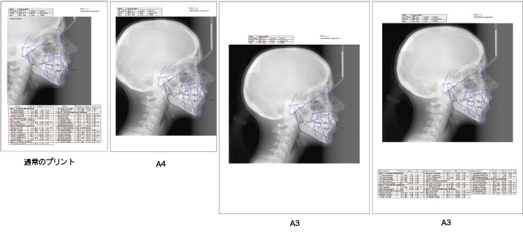 A4とA3のビューレイアウト