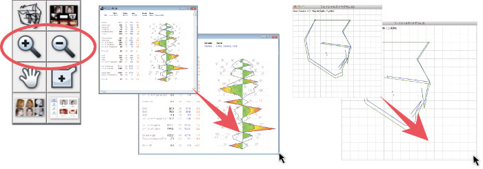 Enlarge/Shrink the window of Polygon and Superimposition 