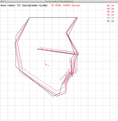 Multiple Facial Diagram Display within the Folder