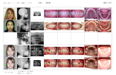 Improvement of AtoZ data Browser.