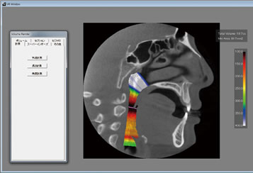 Airway