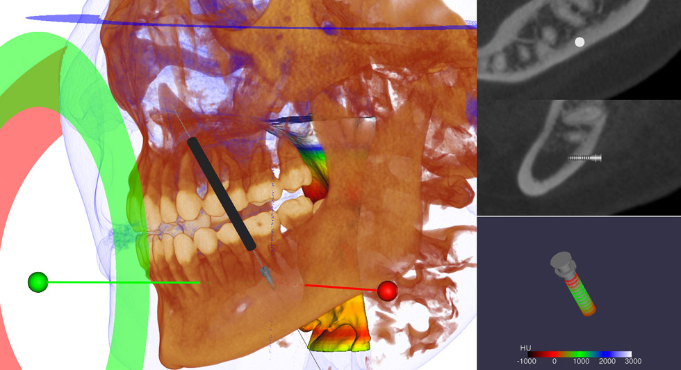 CephaloMetrics AtoZ Ver.16.5