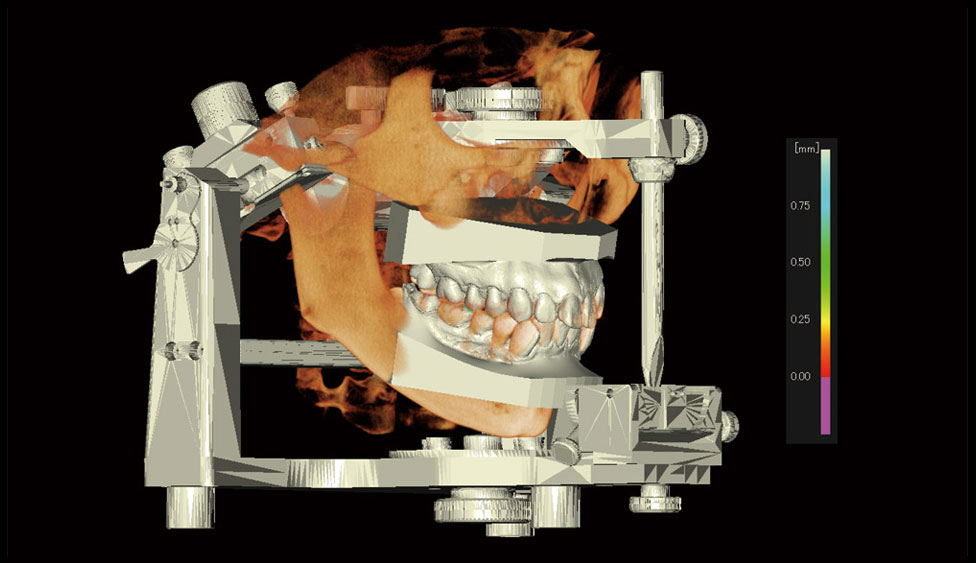 CephaloMetrics AtoZ Ver.16.5