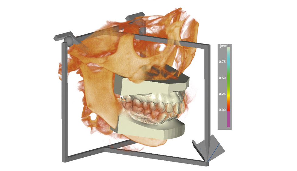 CephaloMetrics AtoZ Ver.16.5