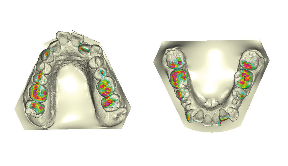 CephaloMetrics AtoZ Ver.16.5