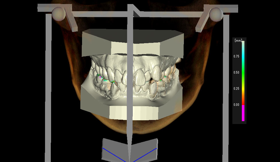 CephaloMetrics AtoZ Ver.16.5