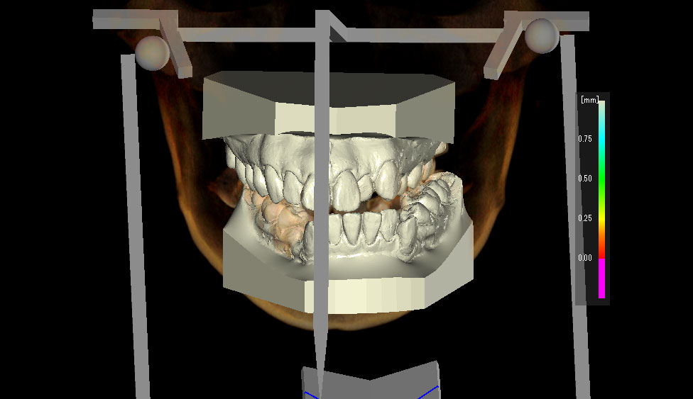 CephaloMetrics AtoZ Ver.16.5