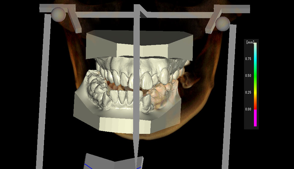 CephaloMetrics AtoZ Ver.16.5