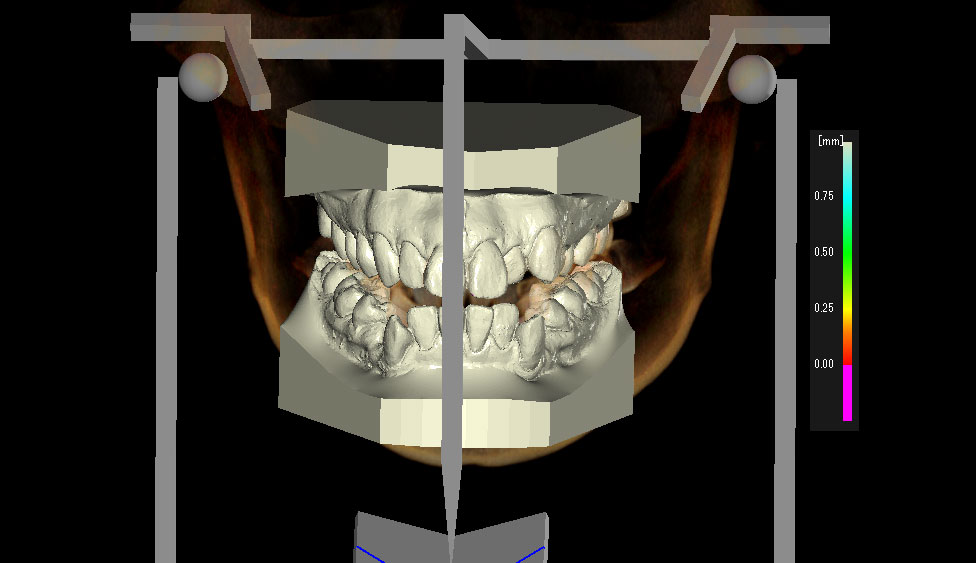 CephaloMetrics AtoZ Ver.16.5