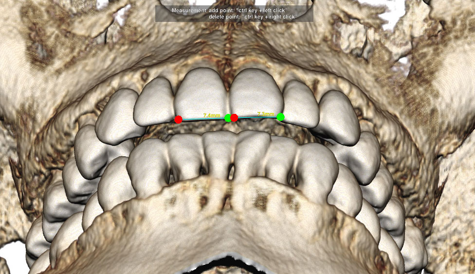 CephaloMetrics AtoZ Ver.16.5