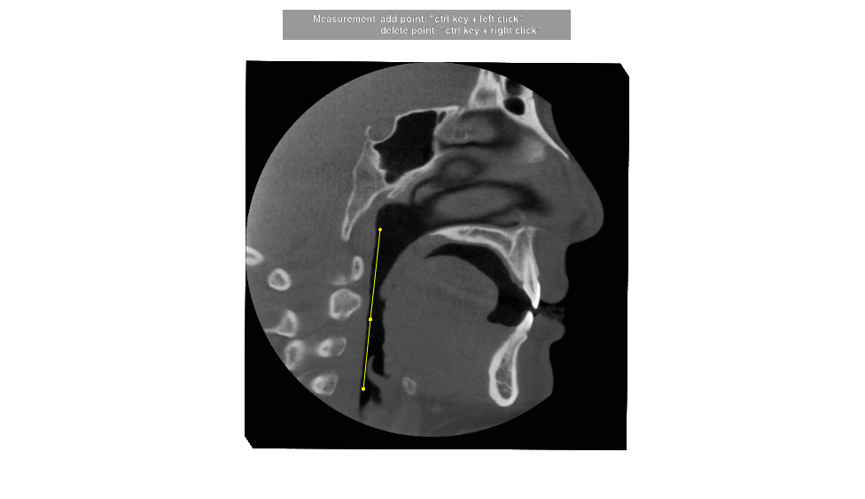 CephaloMetrics AtoZ Ver.16.5