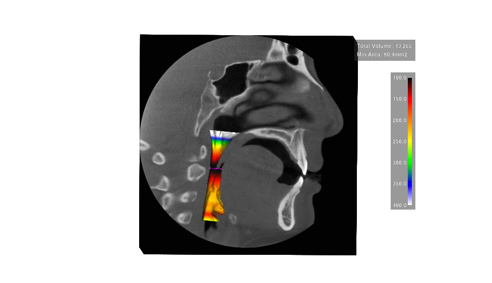 CephaloMetrics AtoZ Ver.16.5