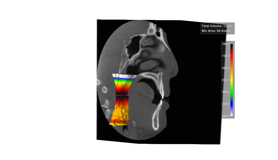 CephaloMetrics AtoZ Ver.16.5