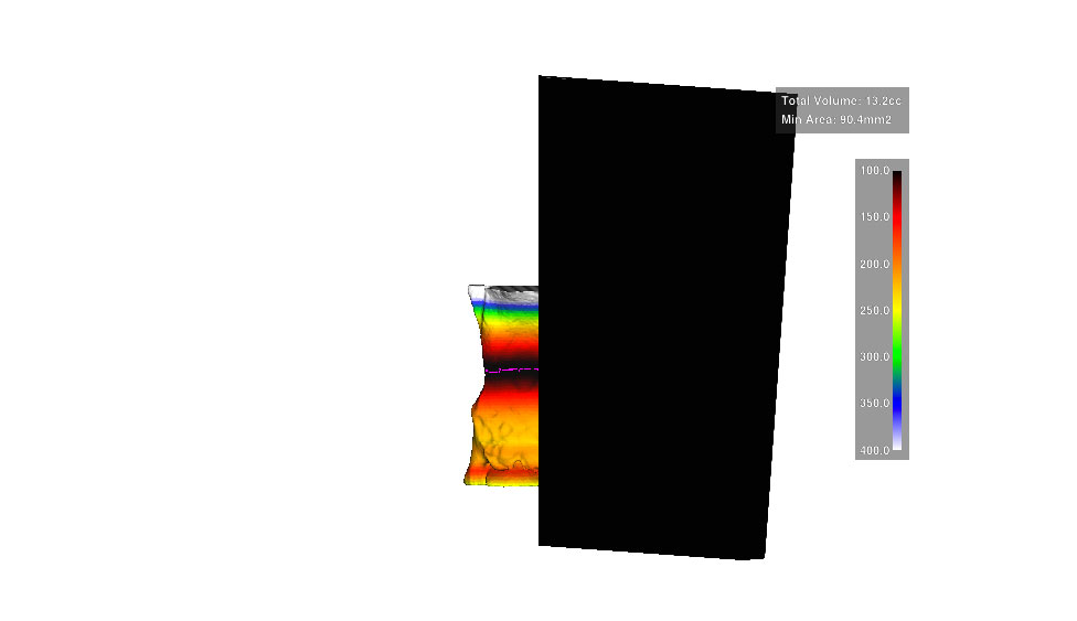 CephaloMetrics AtoZ Ver.16.5