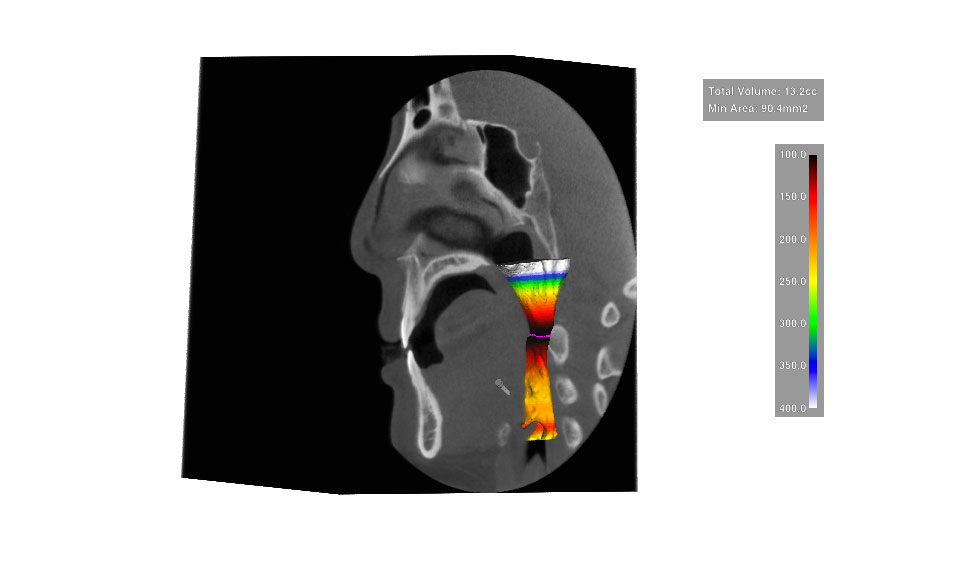 CephaloMetrics AtoZ Ver.16.5