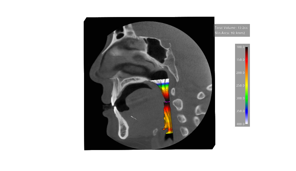 CephaloMetrics AtoZ Ver.16.5