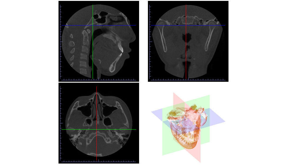 CephaloMetrics AtoZ Ver.16.5