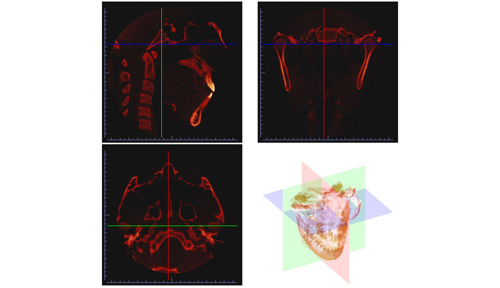 CephaloMetrics AtoZ Ver.16.5