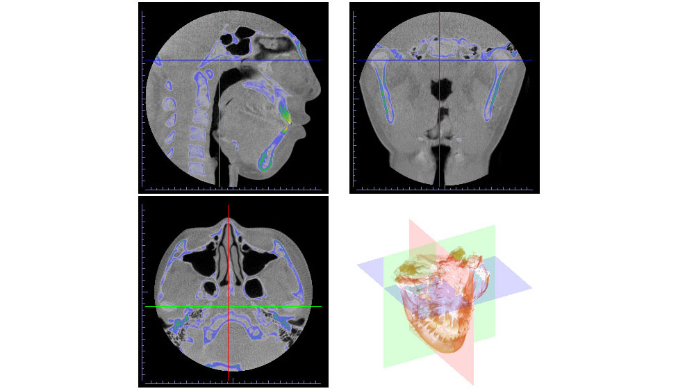 CephaloMetrics AtoZ Ver.16.5