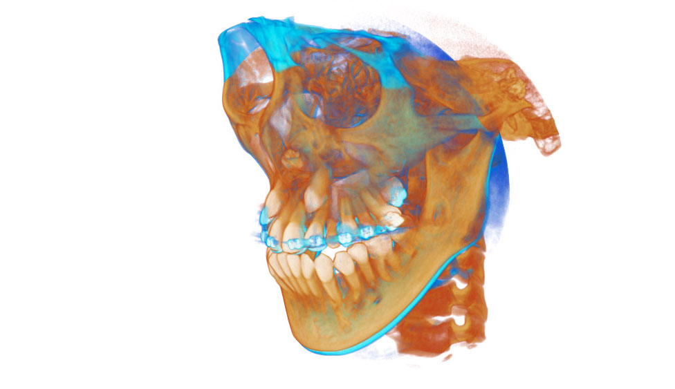 CephaloMetrics AtoZ Ver.16.5