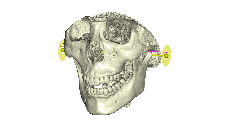 CephaloMetrics AtoZ Ver.16.5