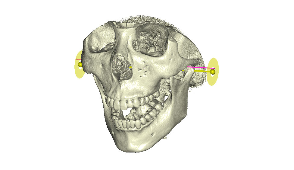 CephaloMetrics AtoZ Ver.16.5