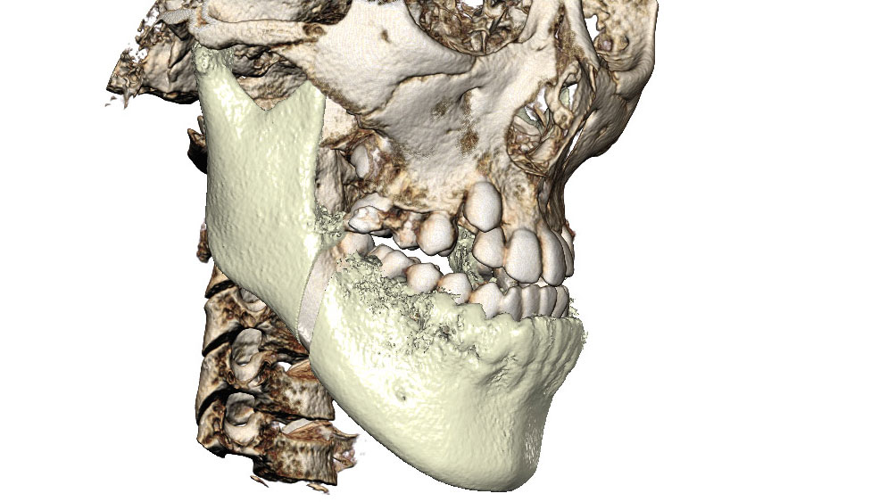 CephaloMetrics AtoZ Ver.16.5