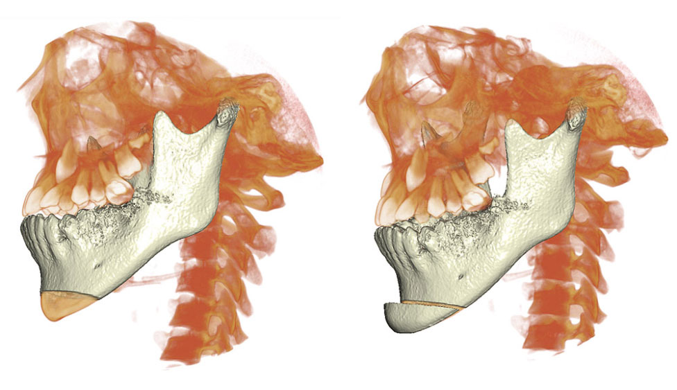 CephaloMetrics AtoZ Ver.16.5