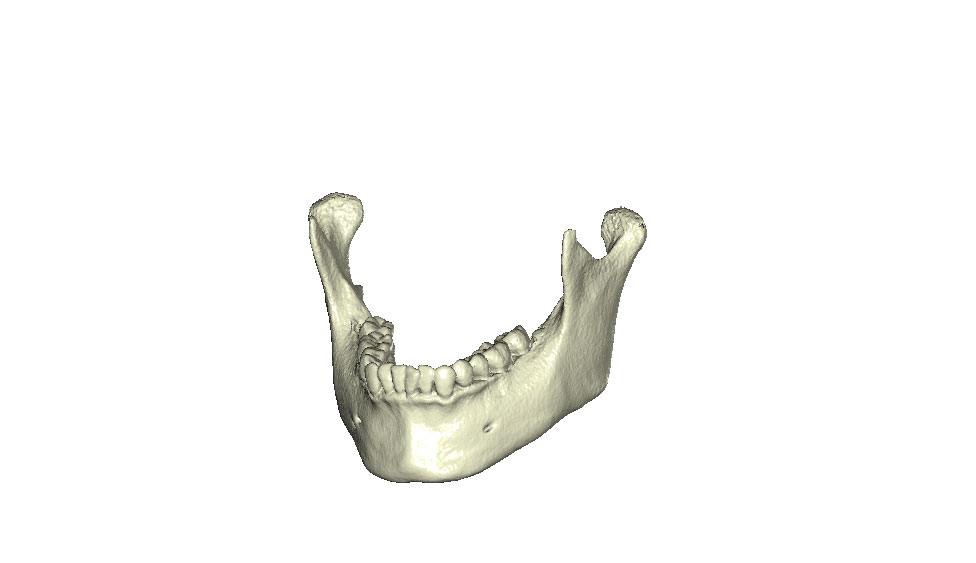 CephaloMetrics AtoZ Ver.16.5