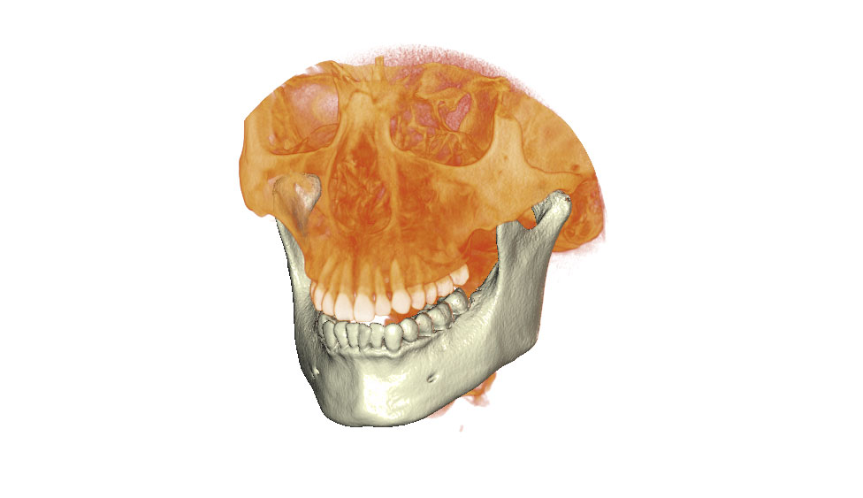 CephaloMetrics AtoZ Ver.16.5