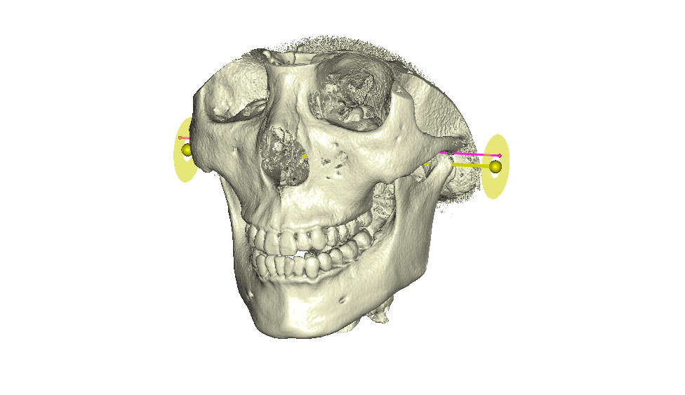 CephaloMetrics AtoZ Ver.16.5