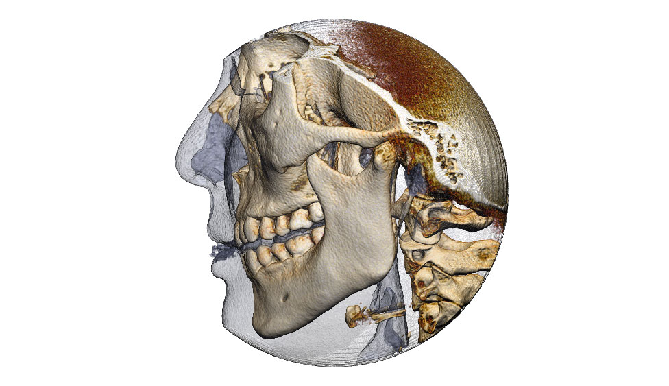 CephaloMetrics AtoZ Ver.16.5