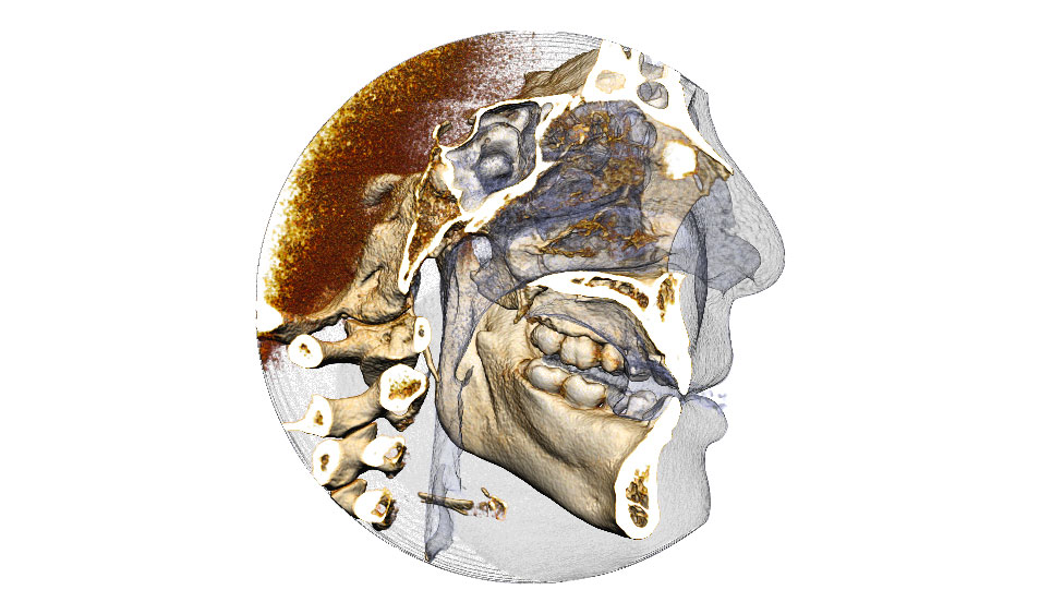 CephaloMetrics AtoZ Ver.16.5