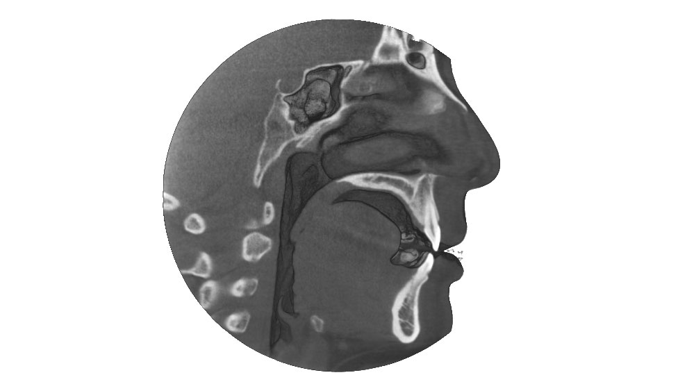 CephaloMetrics AtoZ Ver.16.5