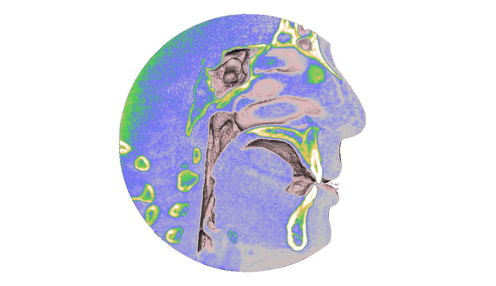 CephaloMetrics AtoZ Ver.16.5