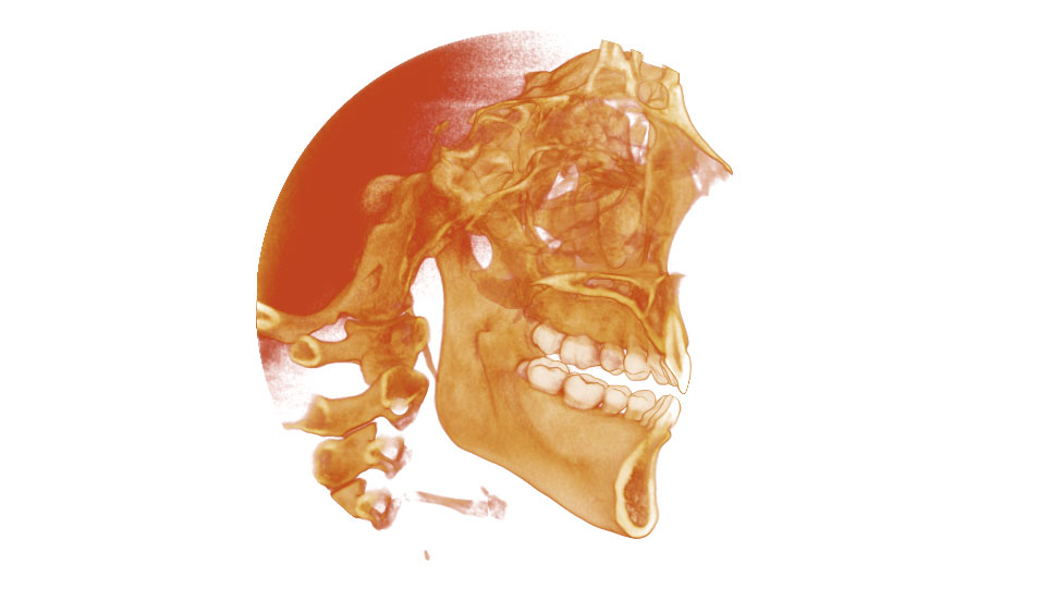 CephaloMetrics AtoZ Ver.16.5