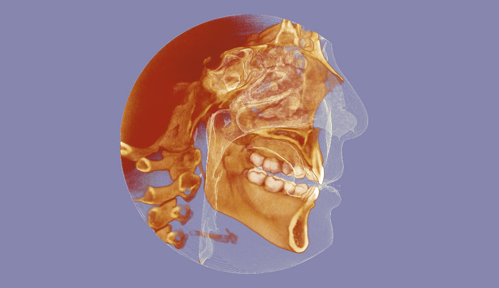 CephaloMetrics AtoZ Ver.16.5