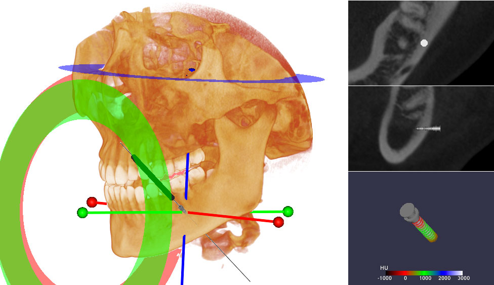 CephaloMetrics AtoZ Ver.16.5