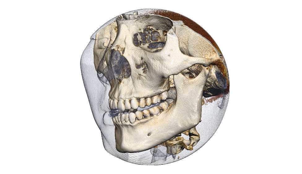 CephaloMetrics AtoZ Ver.16.5