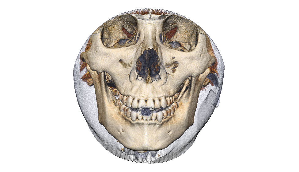 CephaloMetrics AtoZ Ver.16.5