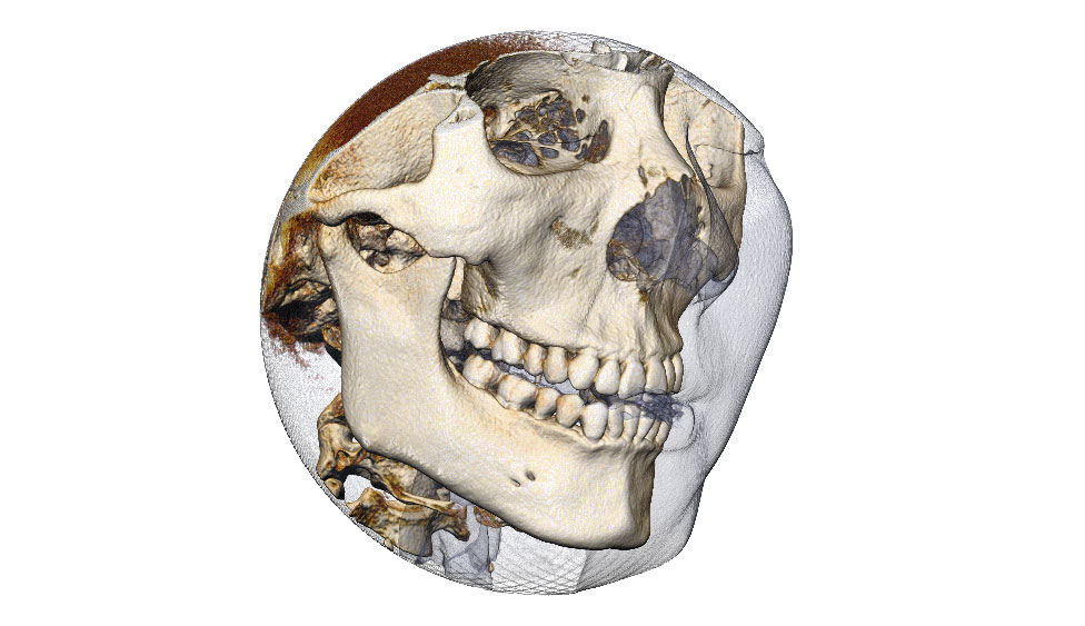 CephaloMetrics AtoZ Ver.16.5