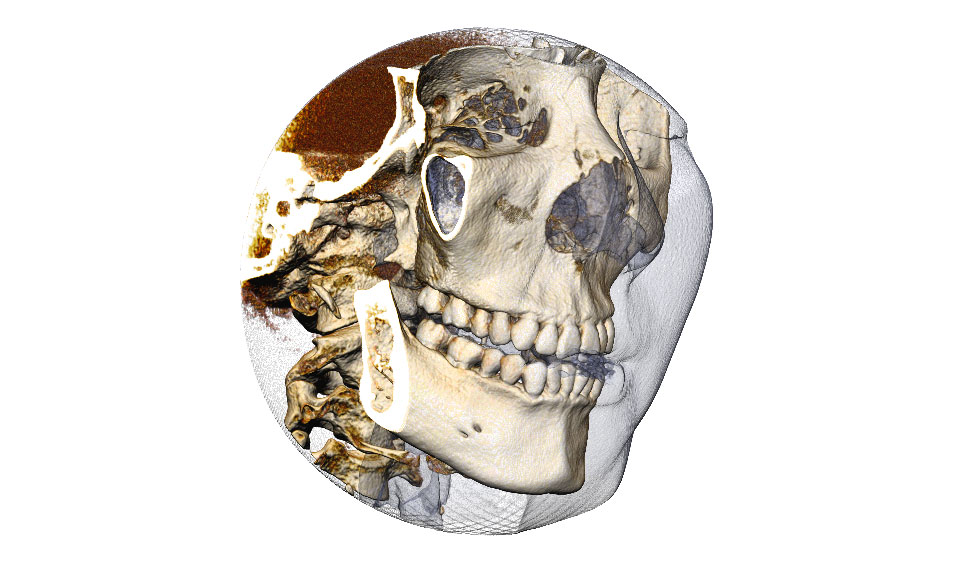 CephaloMetrics AtoZ Ver.16.5