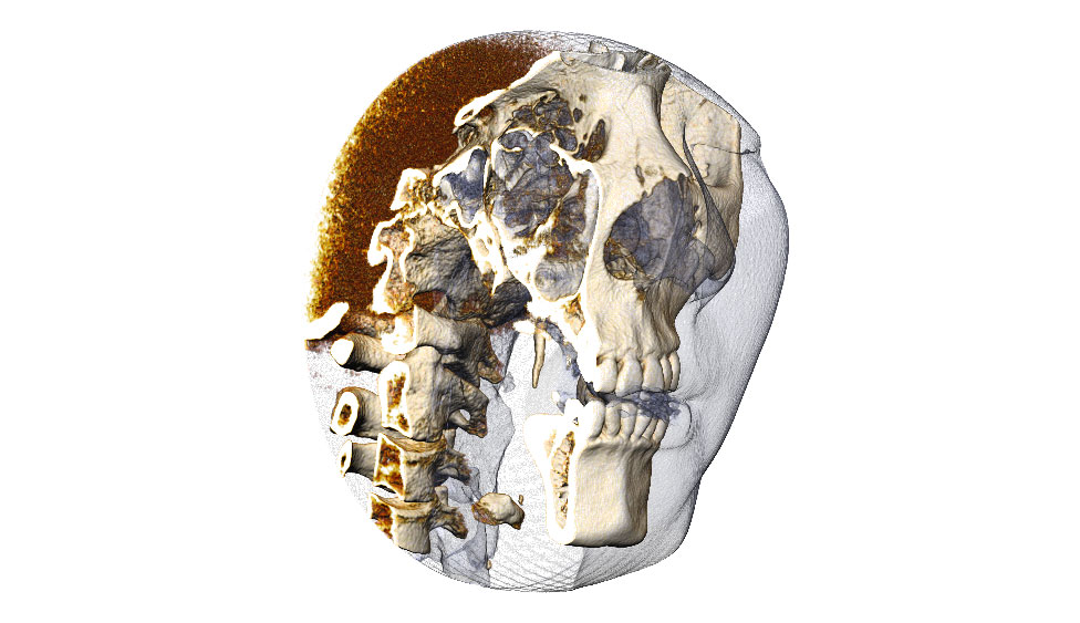 CephaloMetrics AtoZ Ver.16.5