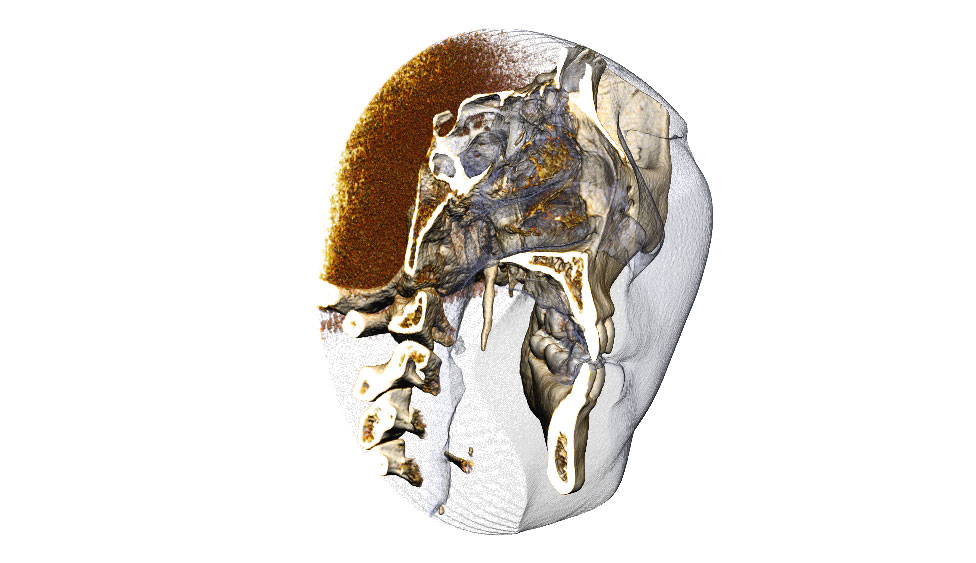 CephaloMetrics AtoZ Ver.16.5